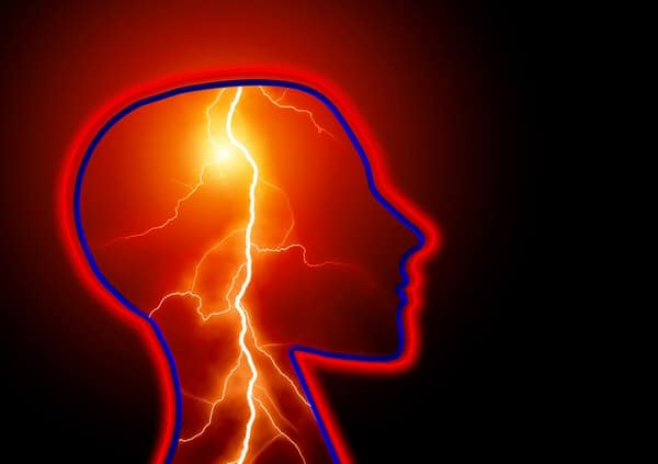 stroke and women+lightning-brain